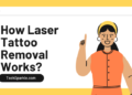 How Laser Tattoo Removal Works